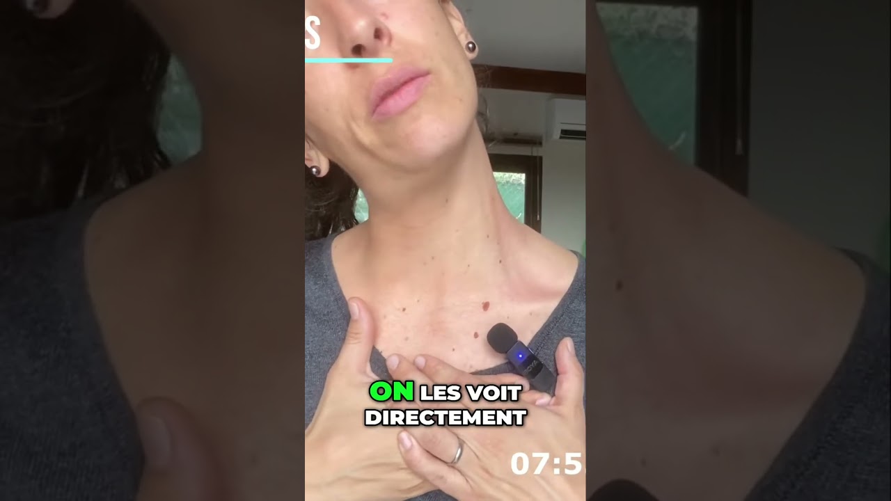 &Eacute;tirement du Cou : Muscles Scal&egrave;nes