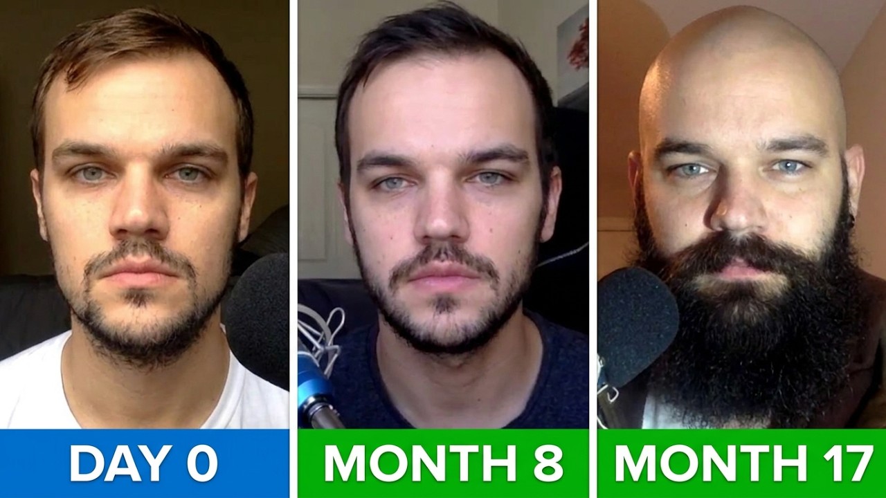 Minoxidil Journey - A Comprehensive Overview