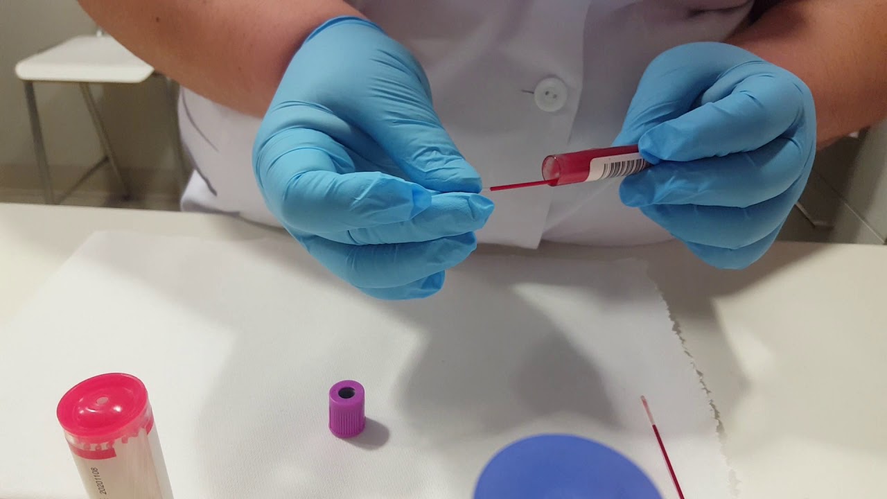 Técnica de Microhematocrito