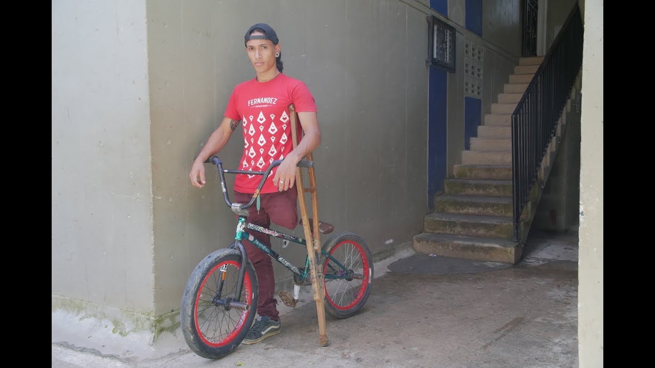 The BMX Stunt Rider With Only One Leg