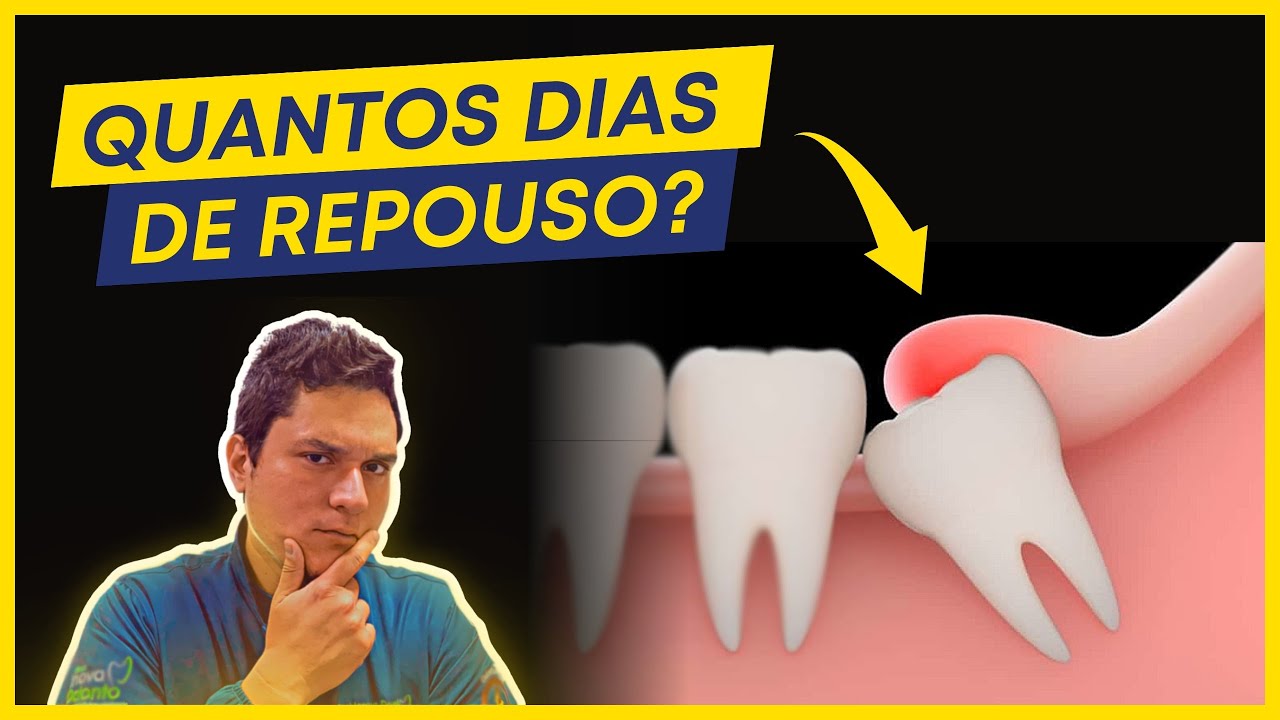 Extração de Dente do Siso: Quantos dias de repouso são recomendados?