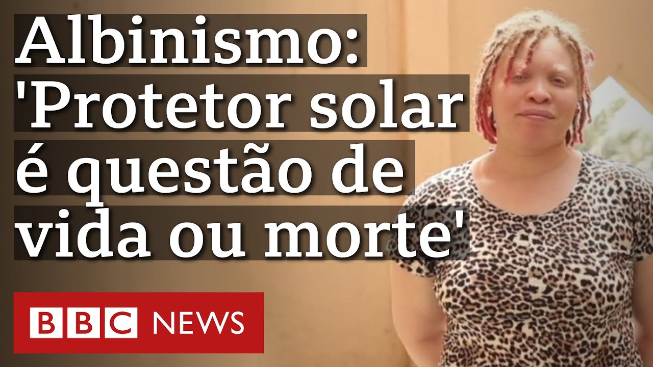 Como mudan&ccedil;as clim&aacute;ticas desafiam sa&uacute;de de pessoas com albinismo