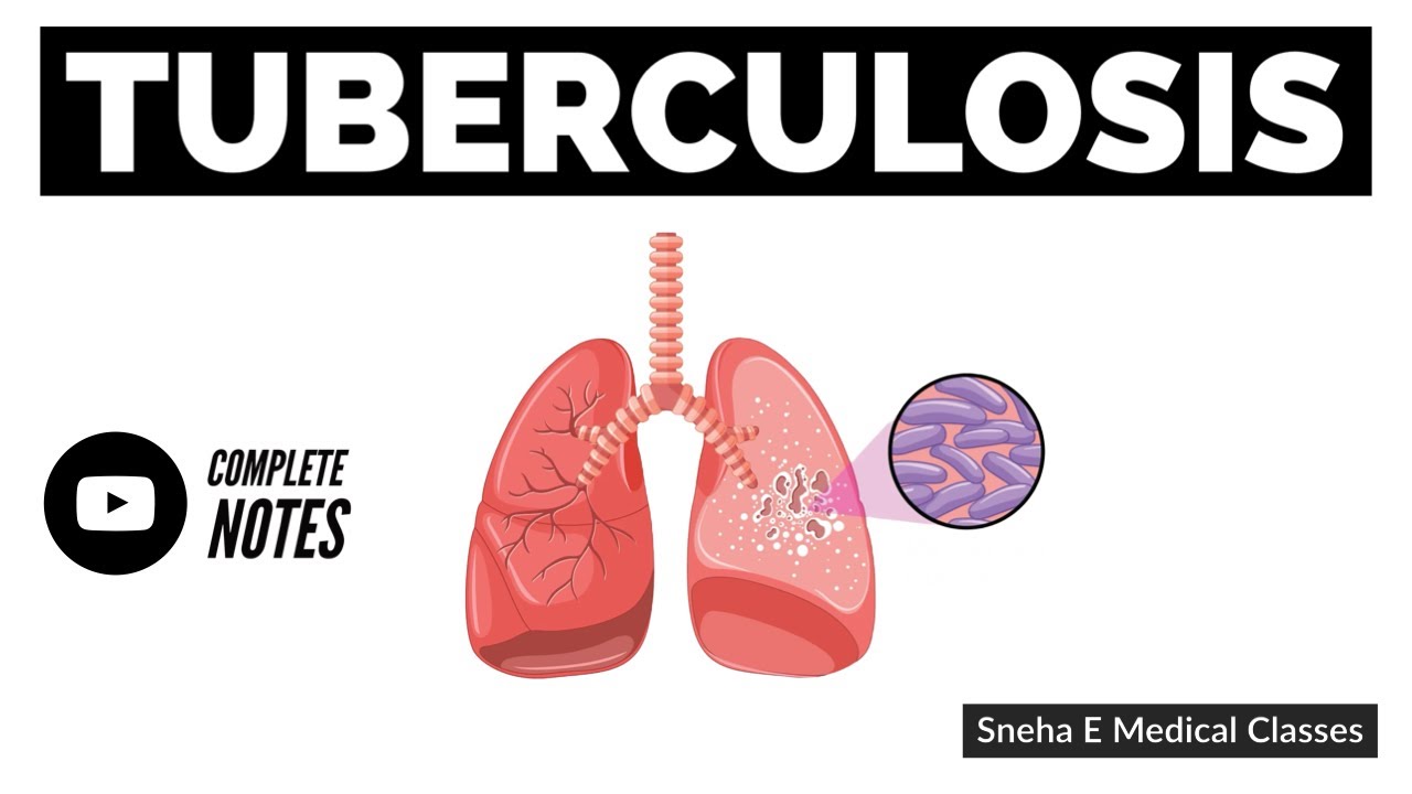 Tuberculosis !! Communicable Disease !!