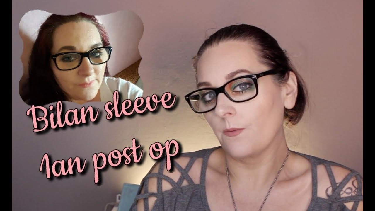 Bilan sleeve - 1 an post op