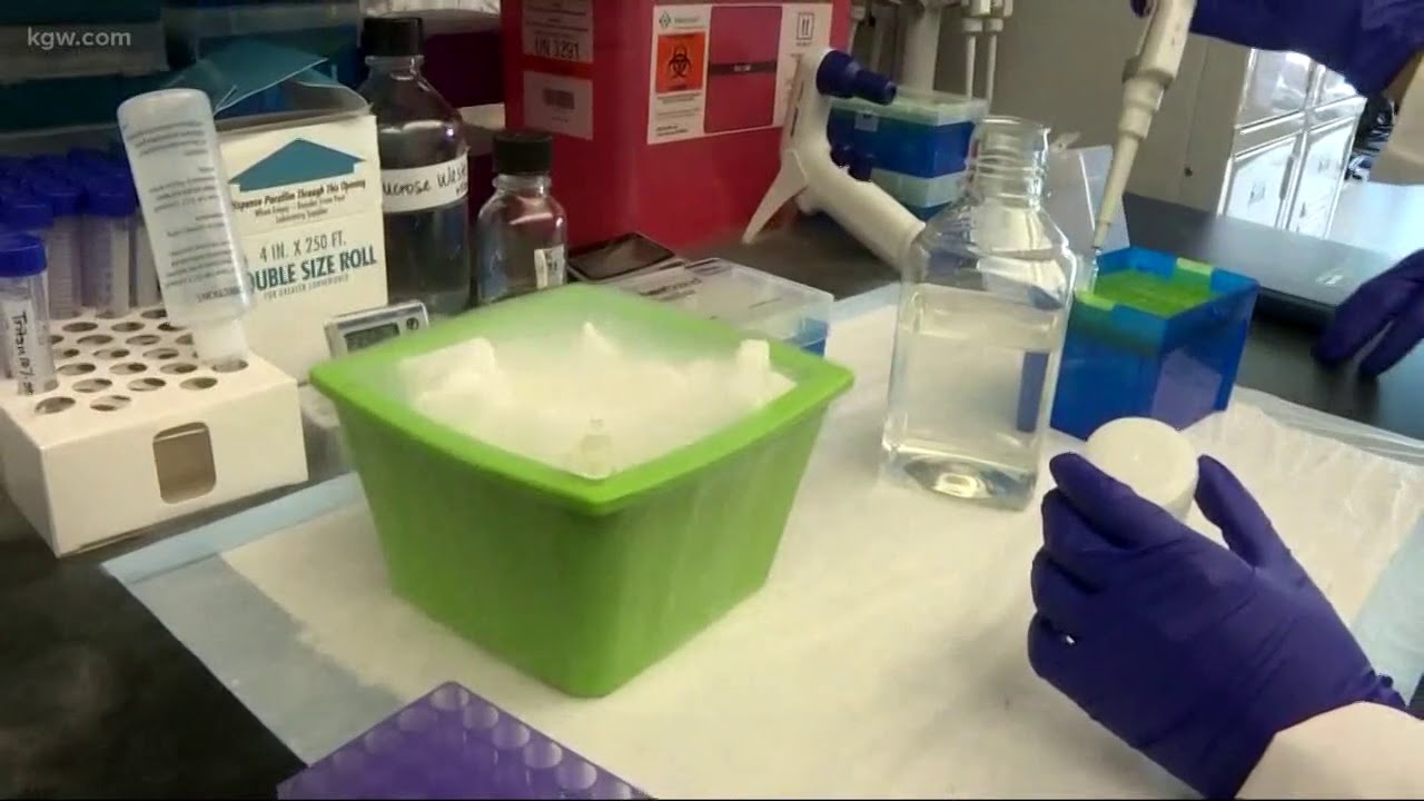 Researchers studying lab-grown brains