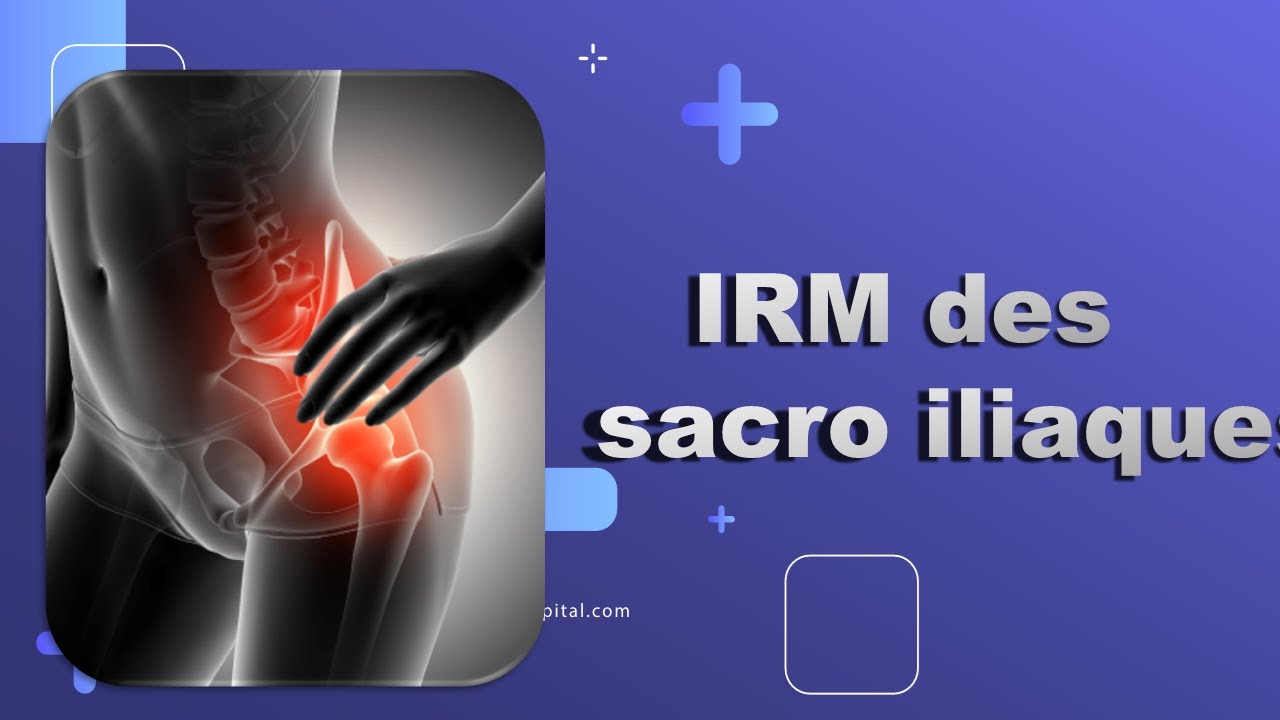 irm sacro iliaque  -Bonne Pratique -