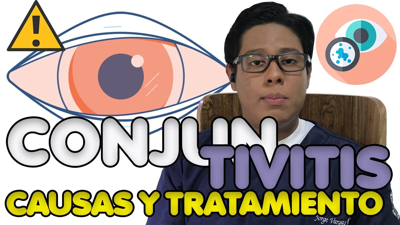 CONJUNTIVITIS - &iquest;Qu&eacute; es? Causas, s&iacute;ntomas y tratamiento