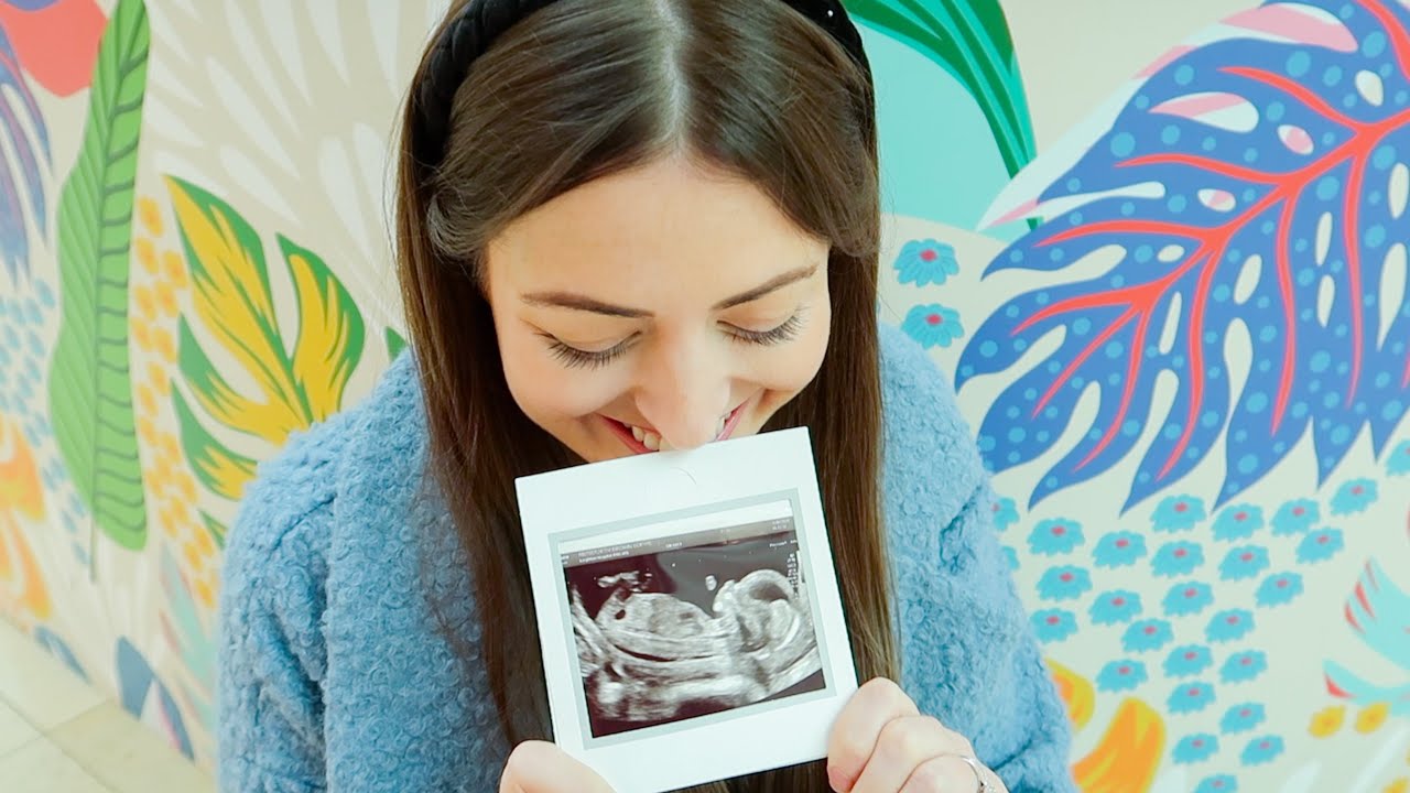 WE SAW OUR BABY! OUR 12 WEEK SCAN