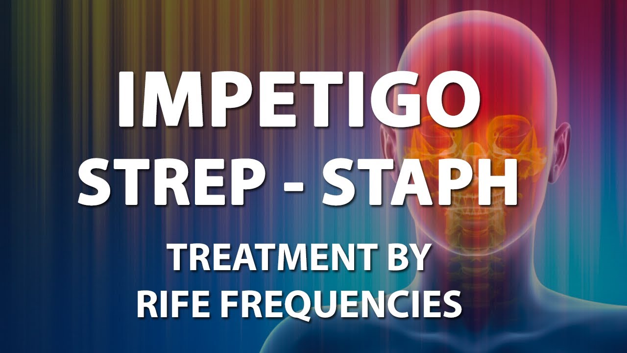 Impetigo - Strep - Staph - RIFE Frequencies Treatment - Energy & Quantum Medicine with Bioresonance