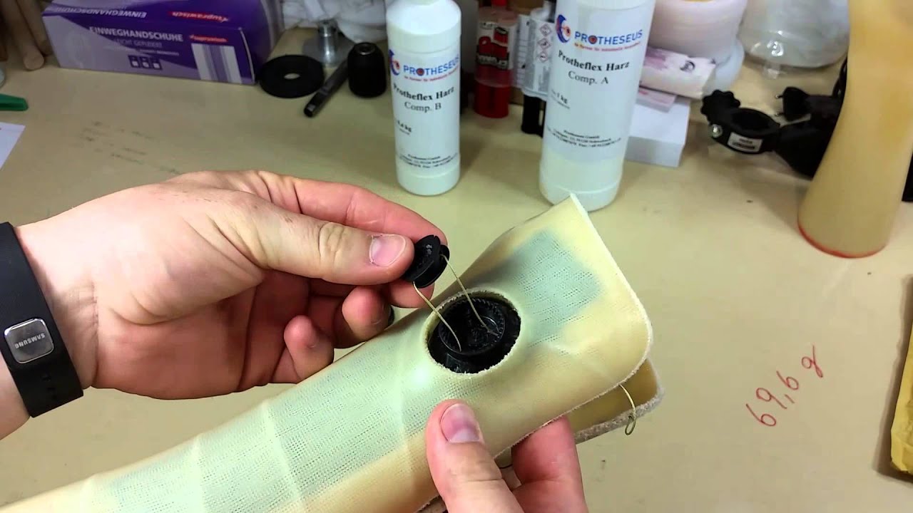 Hand orthosis made of Protheflex soft resin with Boa system - assembly