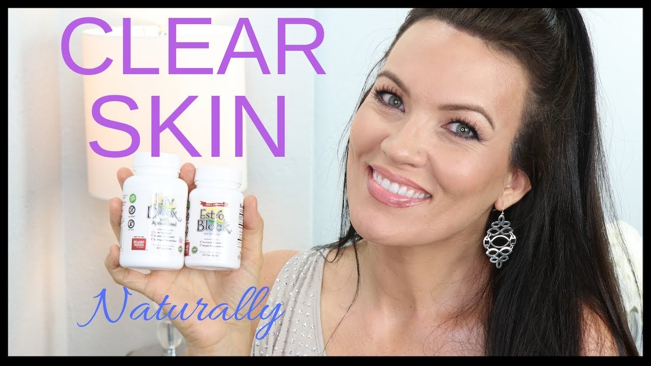 HOW I CLEARED my HORMONAL ACNE - NATURAL cure for ACNE - PCOS, CYSTIC ACNE, ADULT ACNE