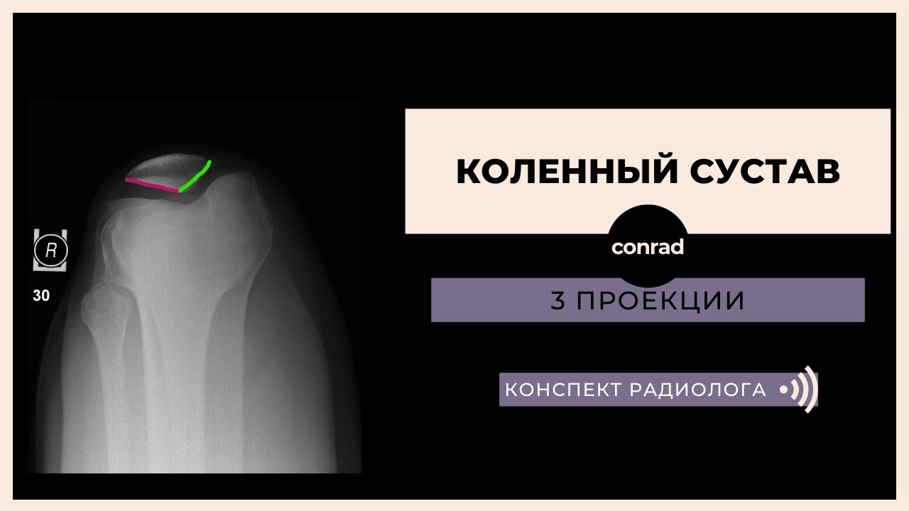 Нормальная рентген-анатомия коленного сустава