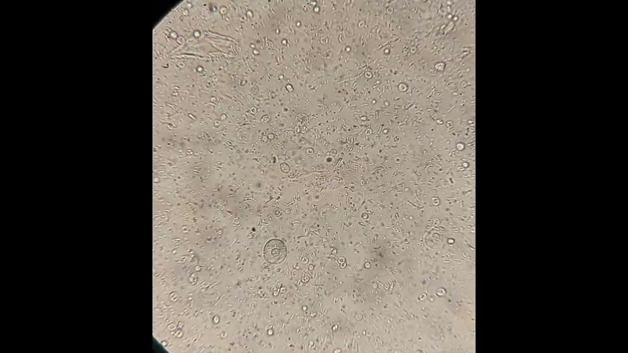 GUE (Rbc and epithelial cell)