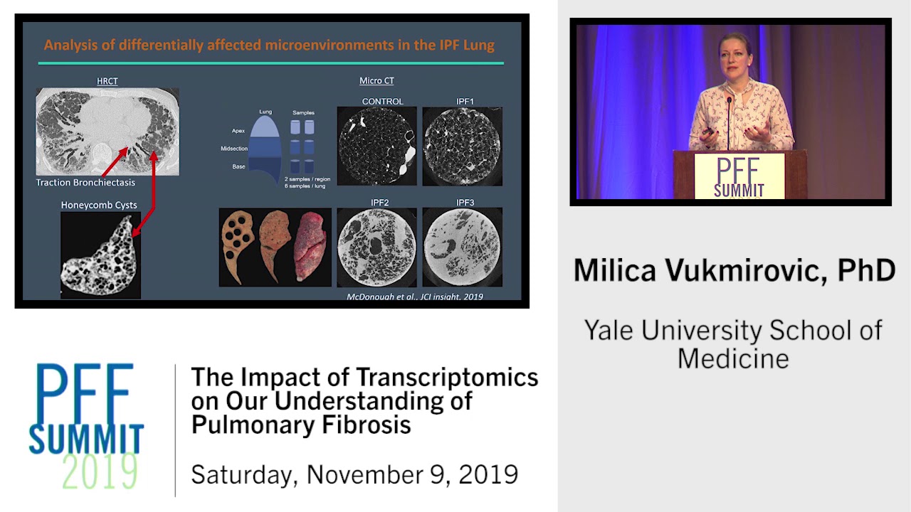 The Impact of Transcriptomics on Our Understanding of Pulmonary Fibrosis | Milica Vukmirovic, PhD