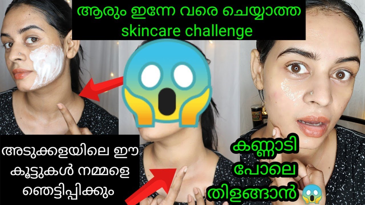 pimple marks, spot's, pigmentation remove 2days clear glowing skincare challenge||amazing result||