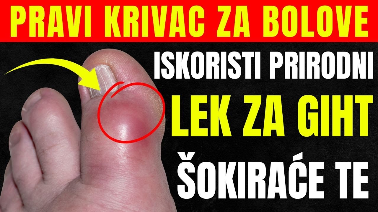 Giht i visoka mokraćna kiselina &ndash; otkrij kako da se spase&scaron; bolova!