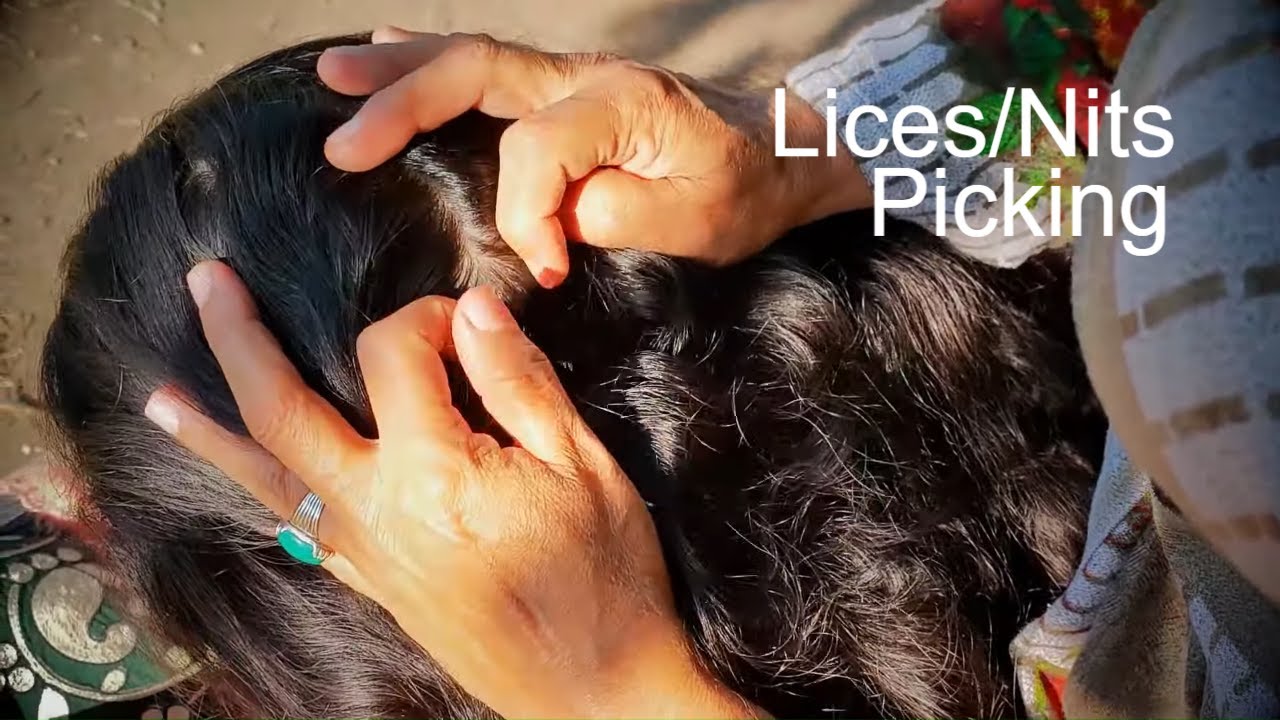 Lice Nits Picking on Black Curly Hairs Scalp Closeup Shots | ASMR Pakistan