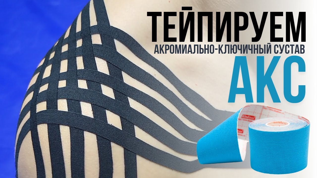 Как зафиксировать ключицу, или акромиально-ключичное сочленение?