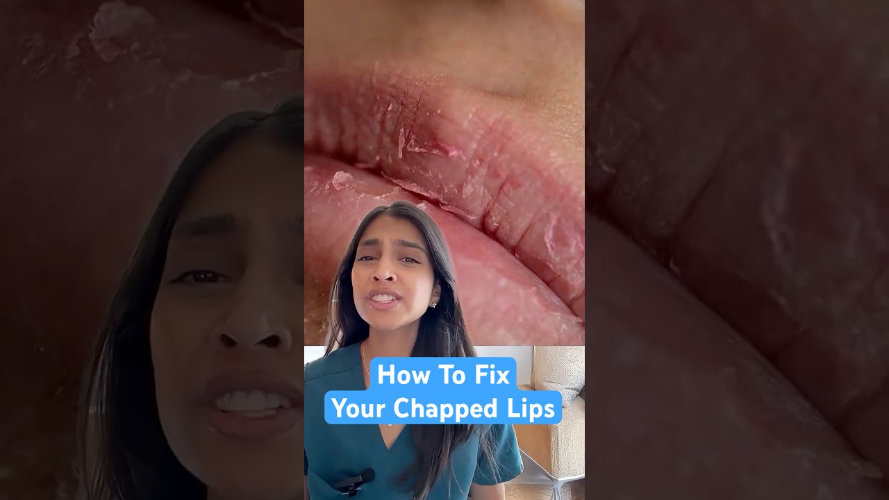 Why Chapstick Isn&rsquo;t Fixing Your Lips