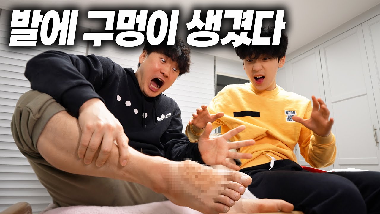 발에 이상한 구멍이 생겼어요... 피부병인가 ㅠㅠ 전염병은 아니겠죠?