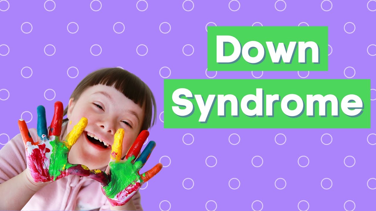 Down Syndrome: Genetics, Symptoms, and Life Long Movement | Trisomy 21
