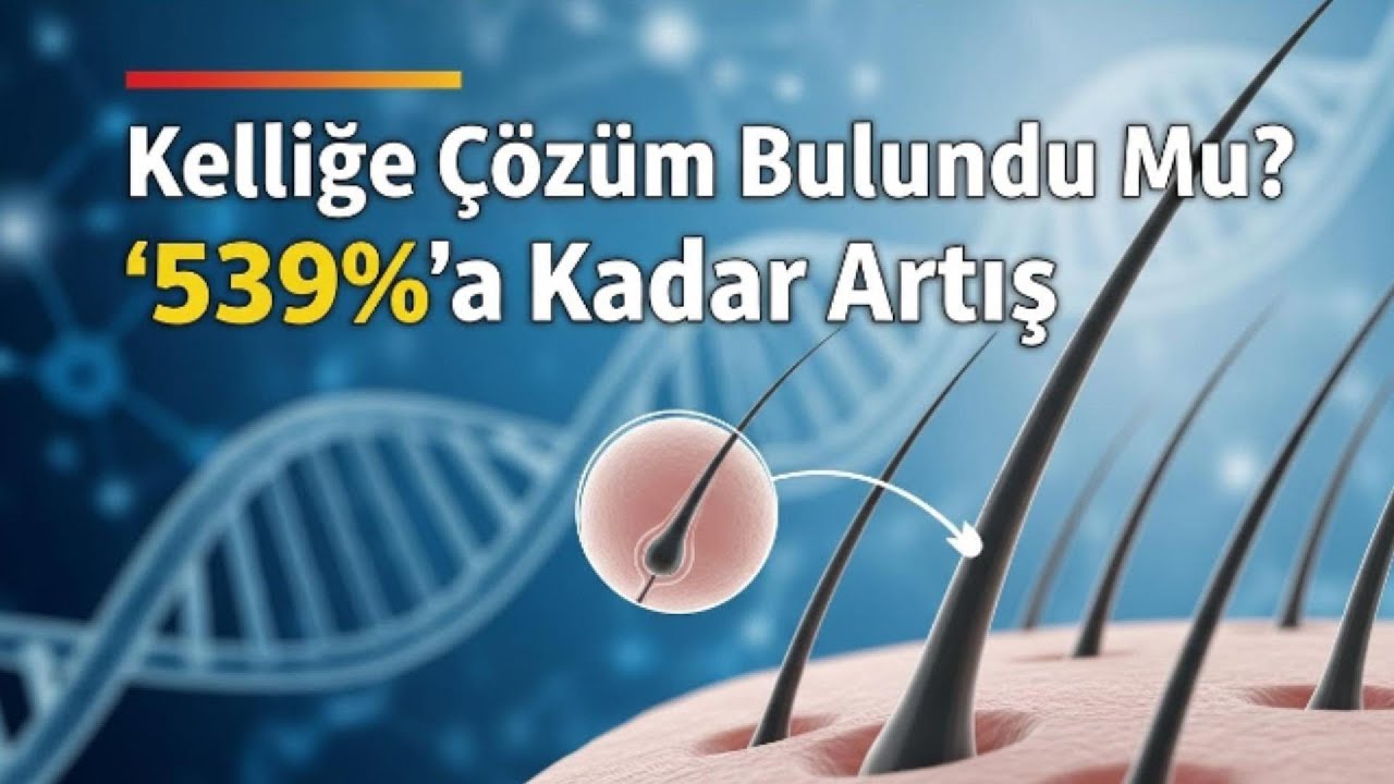 Kelliğe Çözüm Bulundu mu? | %539'a Kadar Artış !!