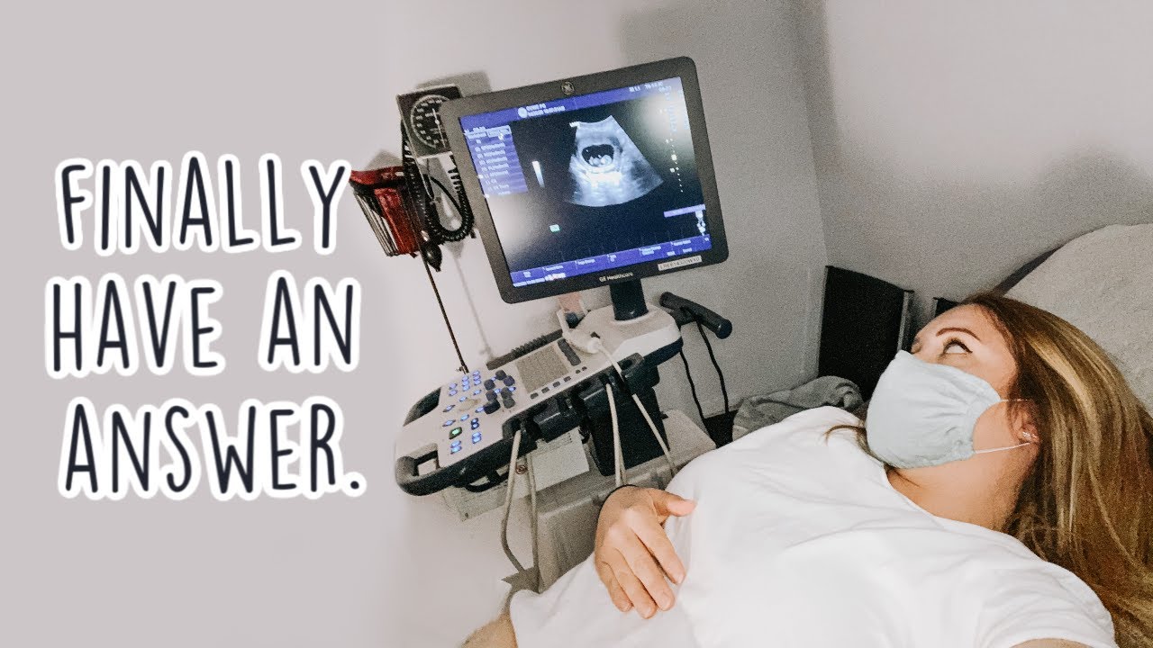 10 WEEK ULTRASOUND! || Are We Having Twins?