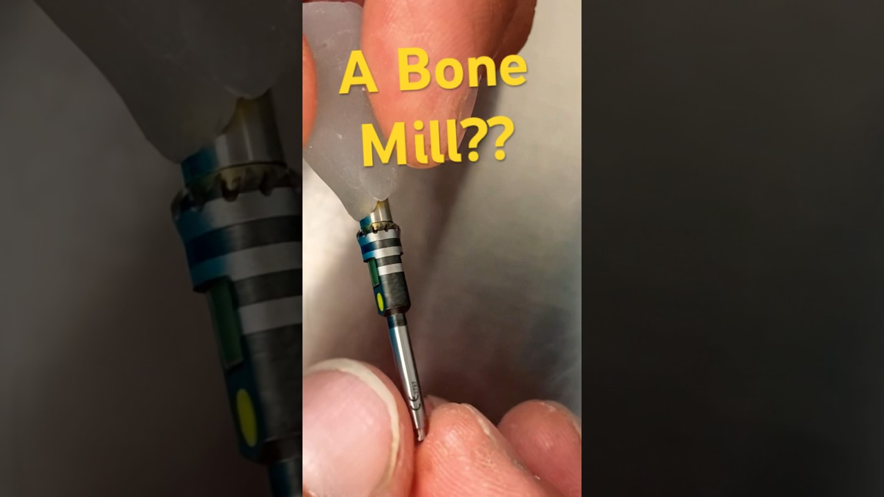 Dental Implant Surgery - Bone Mill #dentistry dentist #dental