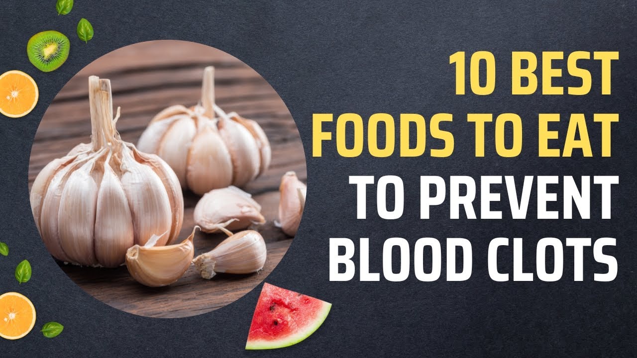 10 Best Foods To Eat To Prevent Blood Clots