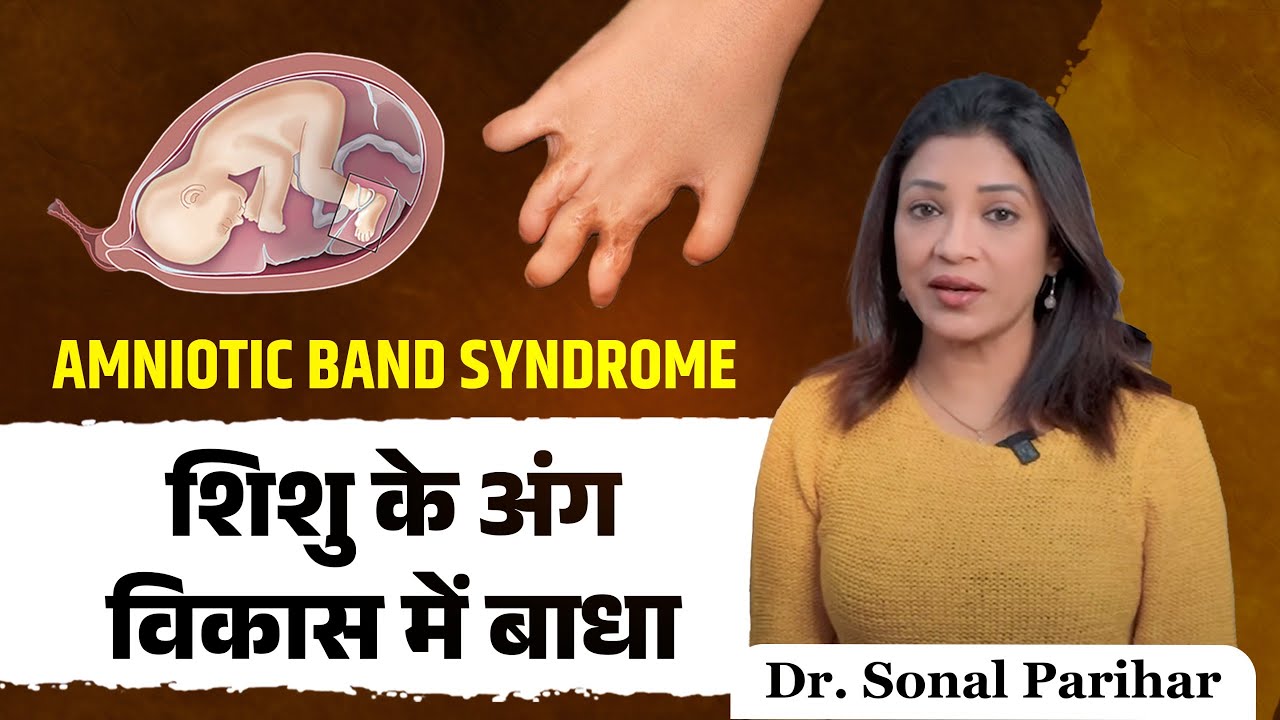 What is Amniotic Band Syndrome? What problems can it cause in the baby's organ development and gr...