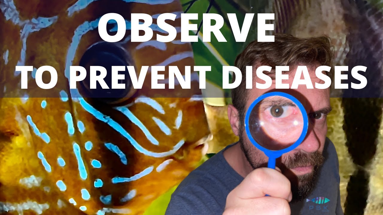 WHAT DO I OBSERVE DAILY IN MY DISCUS?