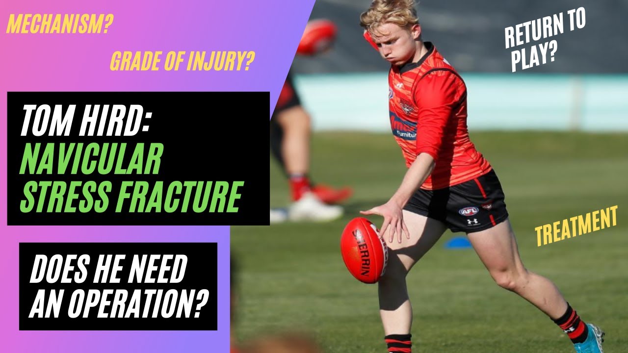Navicular Stress Fracture: Essendon Bomber's Tom Hird - Injury Analysis