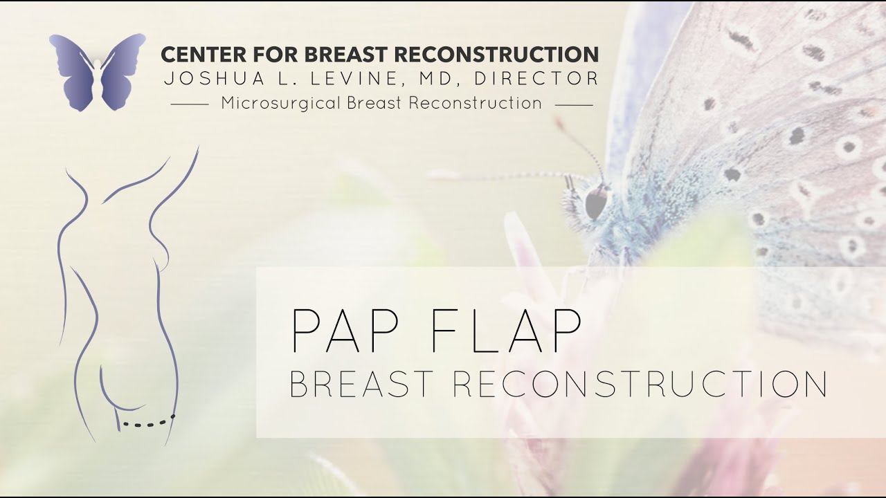 PAP Flap Breast Reconstruction - Guided Illustration - By Dr. Joshua L. Levine