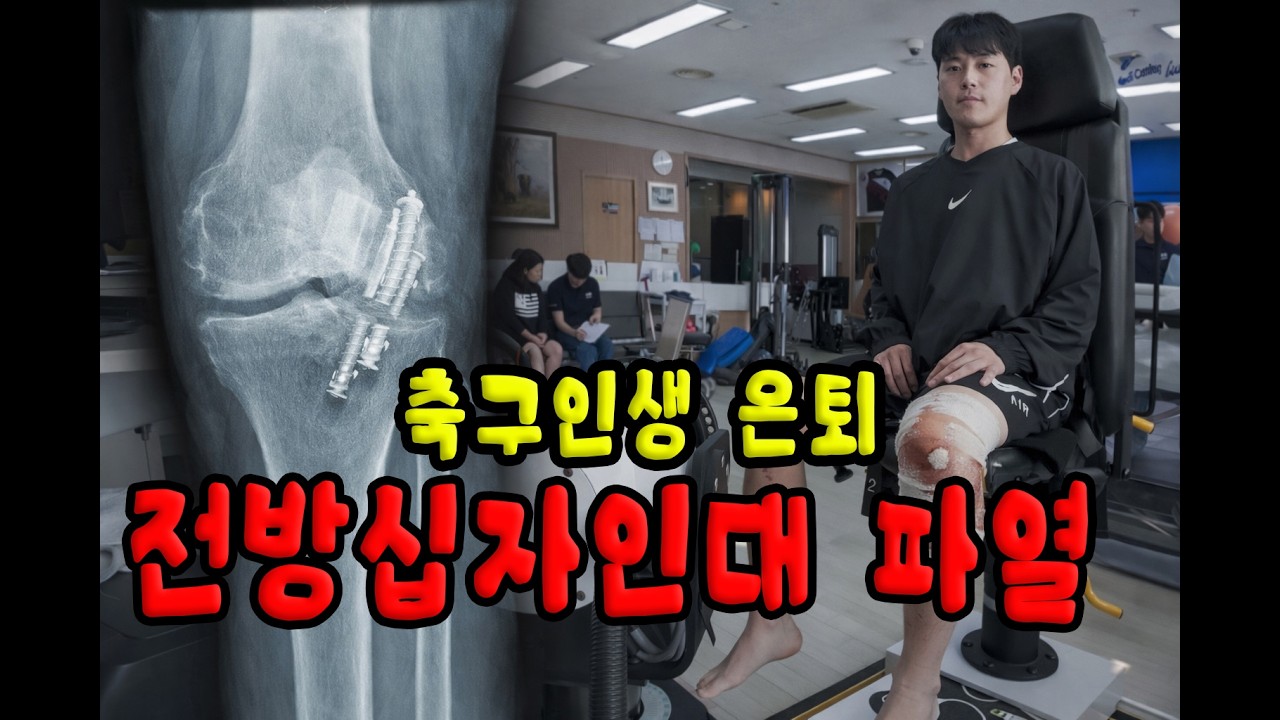 전방십자인대 파열  | 십자인대 수술&재활