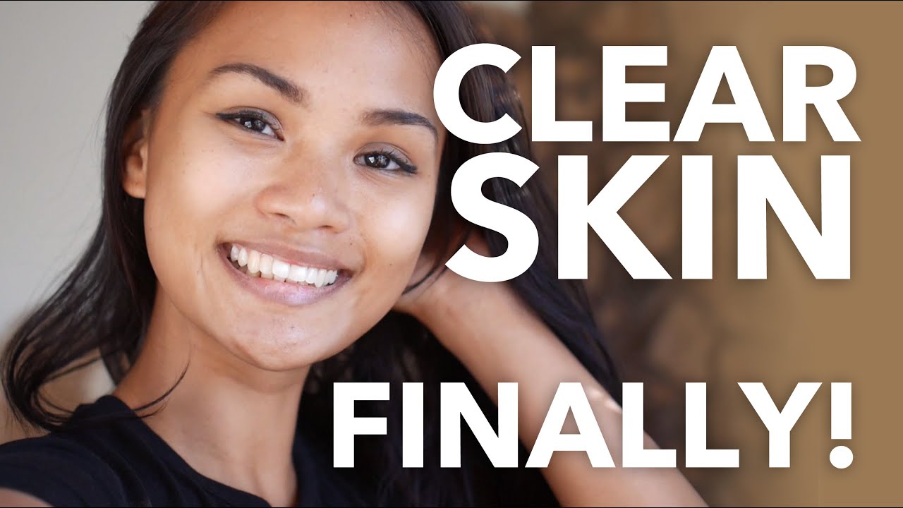 Eczema to FLAWLESS skin (my story!)