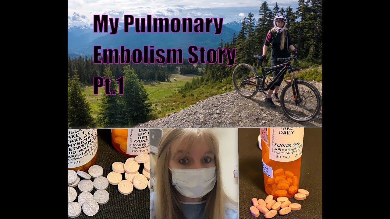 My Pulmonary Embolism Story Pt.1