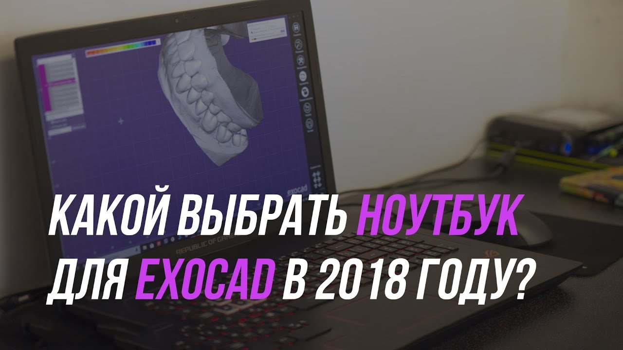 Какой ноутбук выбрать для Экзокада? Exocad