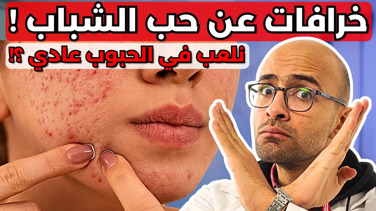 خرافات عن حب الشباب | هل الحبوب معدية ؟ نلعب فيها عادي ؟ بتيجي للشباب بس ؟!