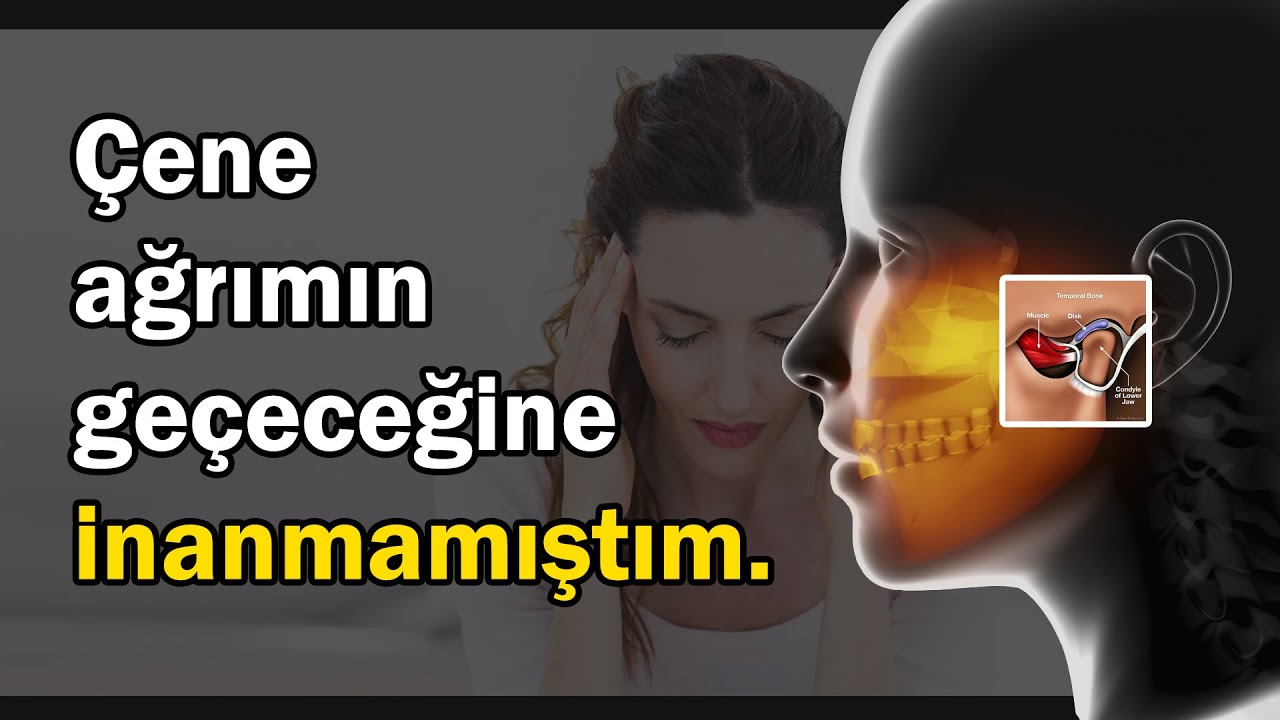 Çene ağrılarından, diş sıkma probleminden kurtulanlar neler dedi?