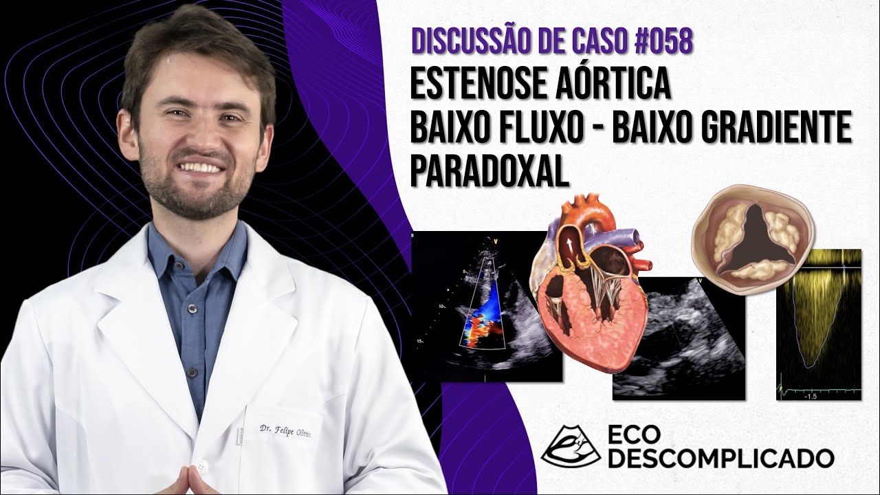 EcoDescomplicado - Discussão de caso #058 - Estenose Aórtica Low-Flow Low-Gradient Paradoxal