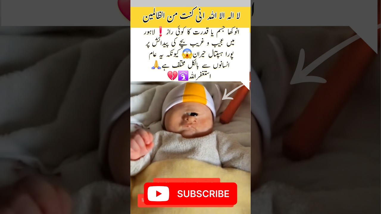 Unbelievable baby born with one eye 👁️🍼 #trending #cute #baby #newborn #babygirl #moments #shorts#yt