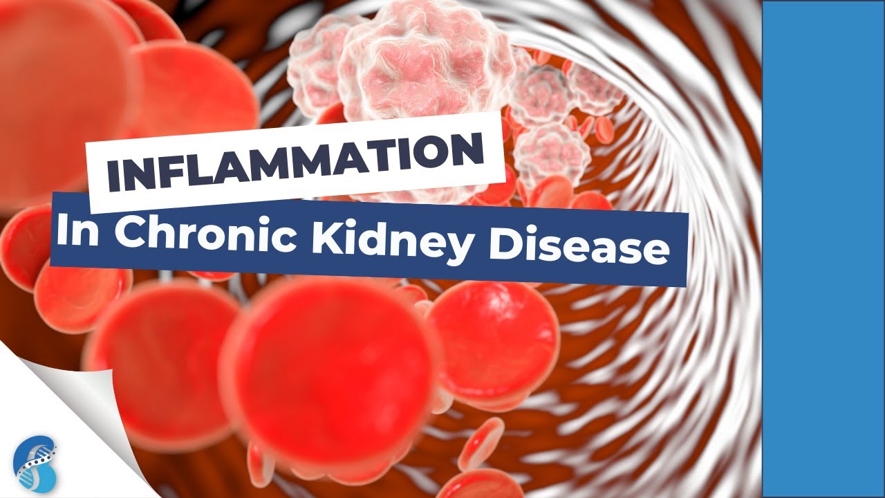 Inflammation in CKD