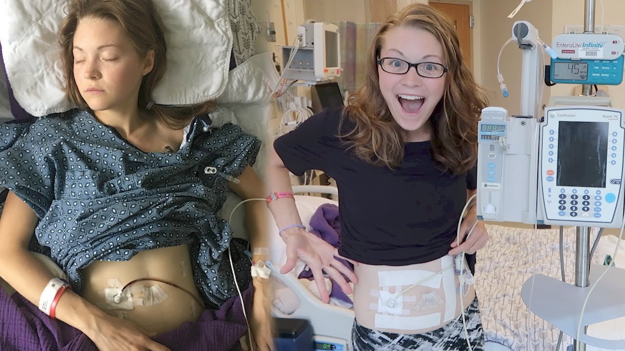 🏥 ADJUSTING TO MY NEW FEEDING TUBE! (4.25.17)