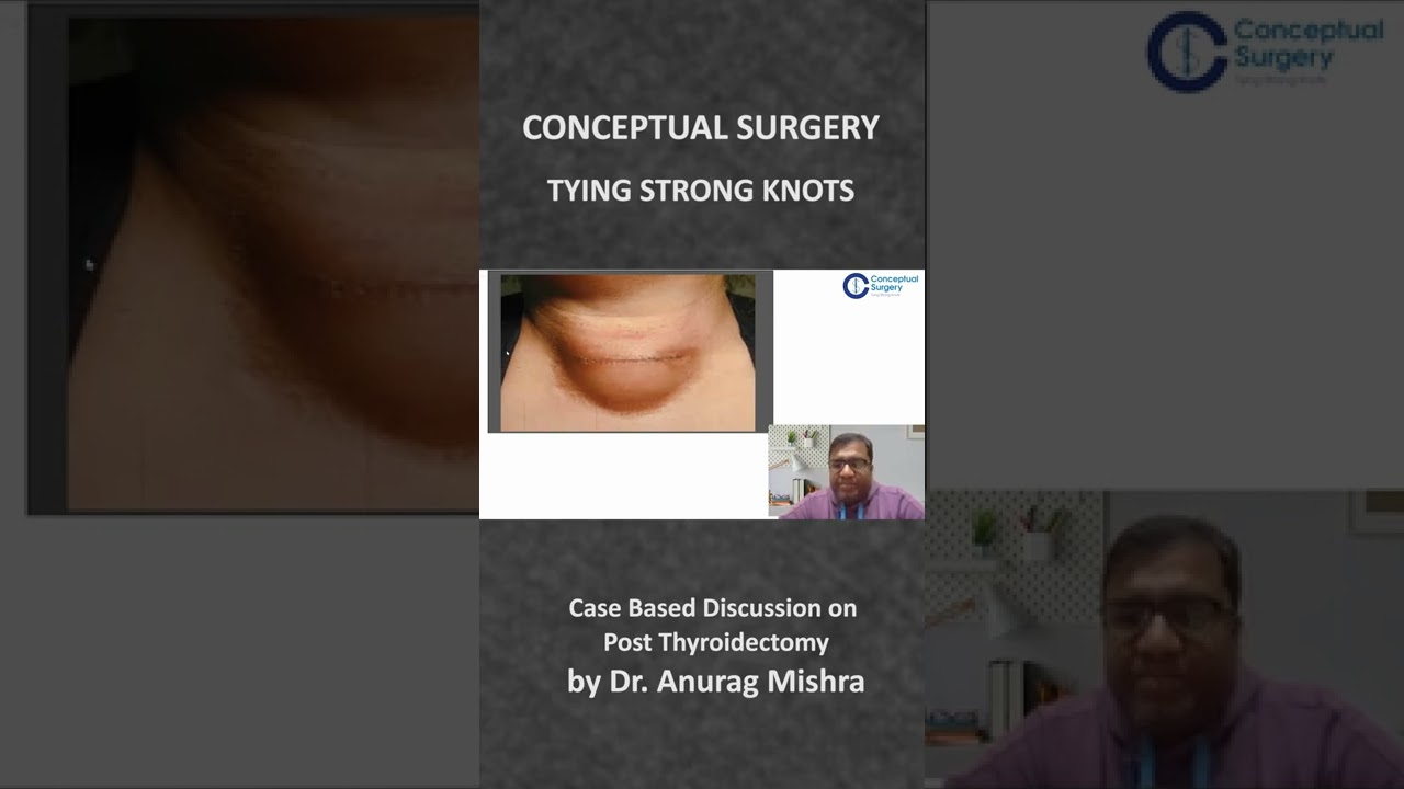 CONCEPTUAL SURGERY 
