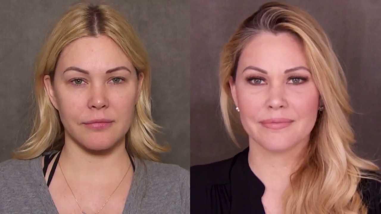 Awake NonSurgical Facelift - Supermodel Shanna Moakler Keeps Her Face Looking Young - Inside Edition