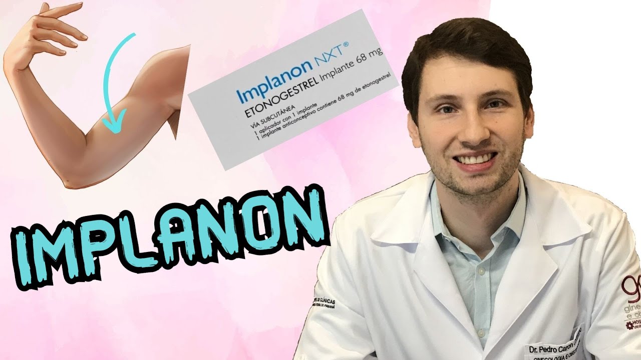 SAIBA: ANTICONCEPCIONAL IMPLANON, como colocar, efeitos colaterais