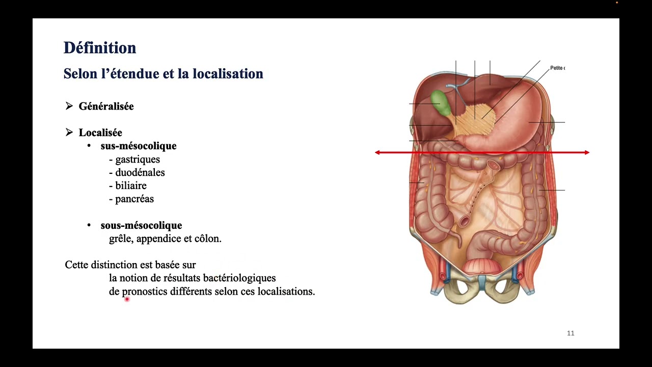 Syndrome Péritonéal - DFGSM2