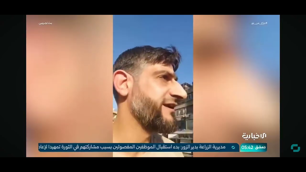 جراح من نور  داريا/ الإخبارية السورية