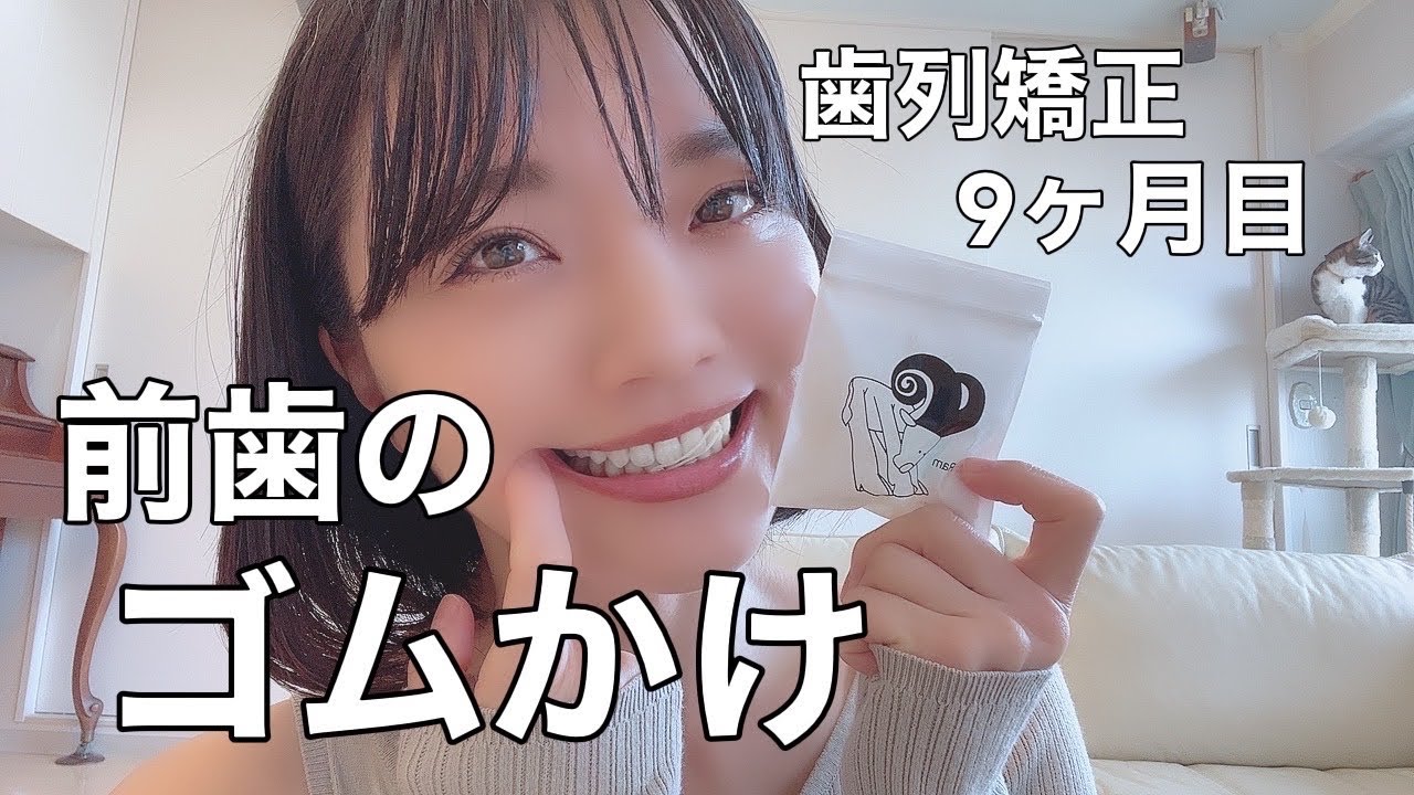 前歯にゴムをかける⁉︎裏側矯正開始から約9ヶ月経過