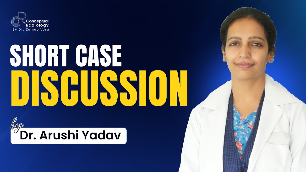 Short Case Discussion by Dr. Arushi Yadav